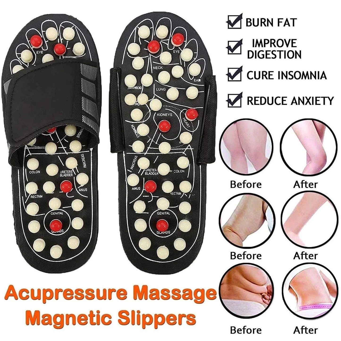Acupressure Sandals